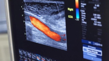 Detail of a vascular imaging monitor